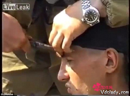 俄士兵微笑拔子弹感动网友眉心中弹安然无事图