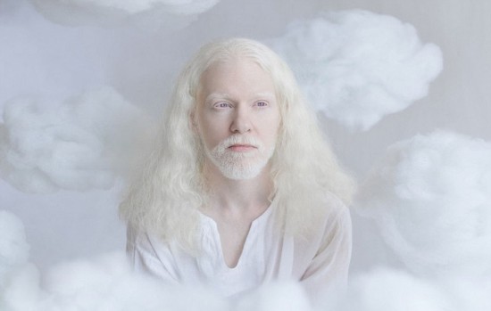 俄摄影师拍摄白化病人唯美似天使组图