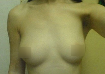 女大学生胸部一大一小差2cup[图]_整 形_资讯_海口