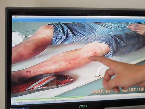 男子自缢身亡 曝光微博遭注销 东方一派出所长