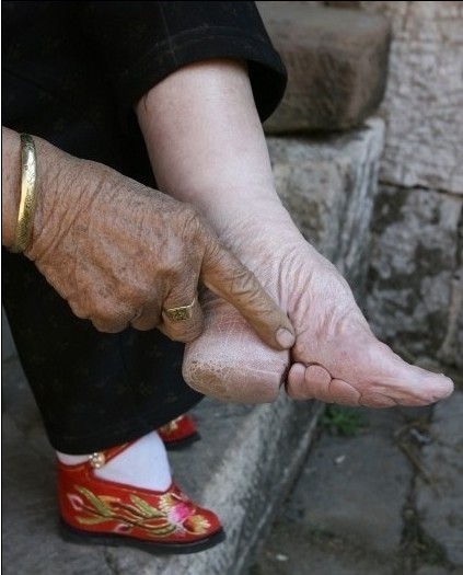 实拍三寸金莲:清末妇女裹脚缠足文化