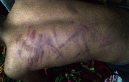 云南富源县中学老师体罚学生4小时 打断5根电