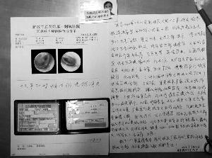 因耳朵剧烈疼痛,石女士前往医院就医,医院的检验报告显示她"双耳鼓膜