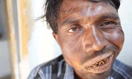 印度奇人日食3公斤砖石泥土图片频道