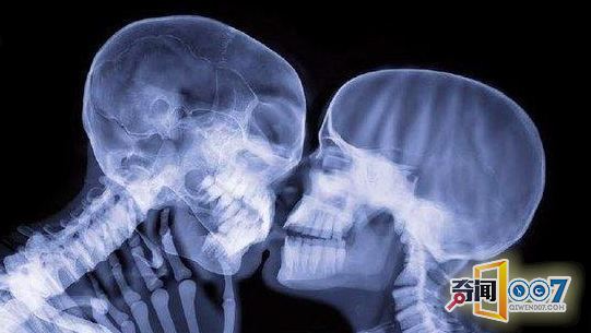 骷髅的世界你不懂! 奇妙的人体X光片图片频道