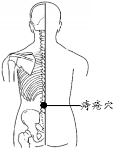 痔疮是很多人难言的隐痛,尤其寒冷冬季,人的整体机能变弱,饮食又偏