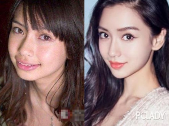 杨幂青涩旧照曝光 变V脸真是因为拔智齿吗?_