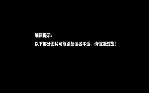 编辑提示:以下部分图片可能引起读者不适,请慎重浏览!