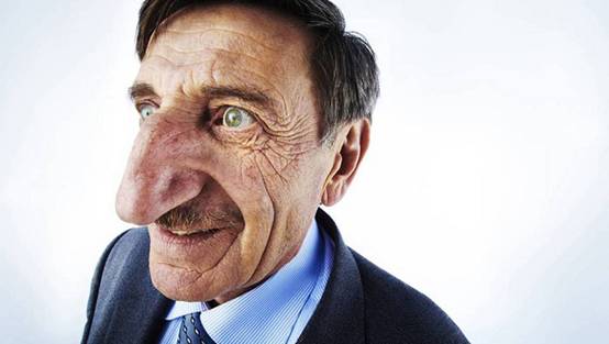 世界最大的胸部! 竟然接近两个成年人的重量