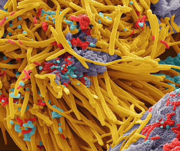 显微镜下的口腔细菌:细长如海洋植物图片频道 - 海口网 - 海口权威新闻门户网站