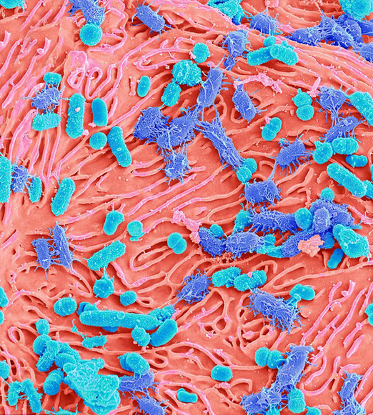 显微镜下的口腔细菌:细长如海洋植物图片频道 - 海口网 - 海口权威新闻门户网站